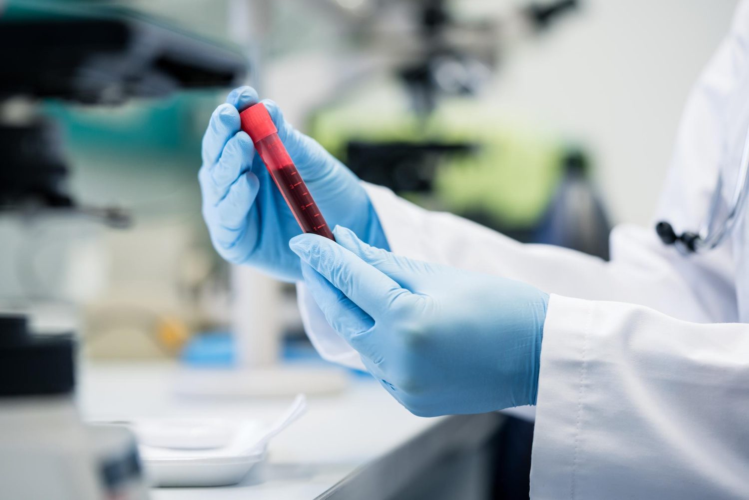 Lab Banks LABORATORY AND BLOOD BANK SERVICES – Pinnacle Hospitals